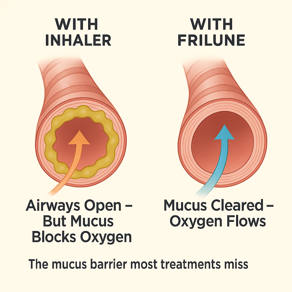From Struggling to Breathe to Breathing Freely — What Your Inhaler Doesn’t Address